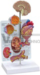   Hypertension Model - mini brain, eye, heart, kidney and artery models (patient education card included)